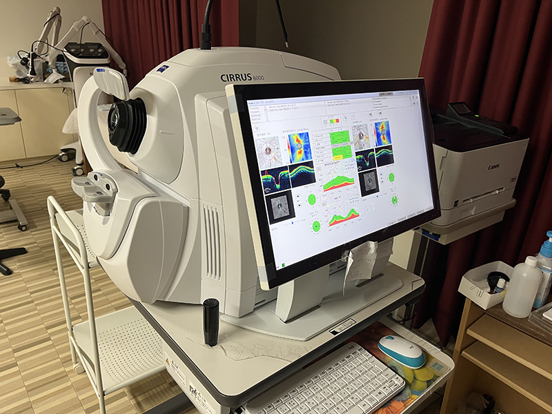 OCT検査：CIRRUS6000(ZEASS)